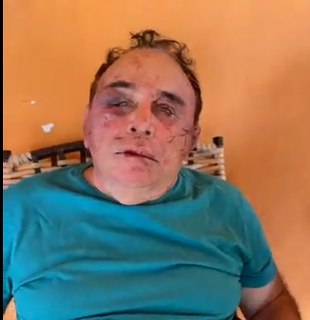 Assaltantes invadem casa de Arimateia, rendem família e agridem brutalmente candidato a prefeito de Santa Terezinha; veja o vídeo